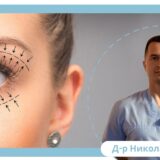 Как блефаропластиката подмладява лицето?